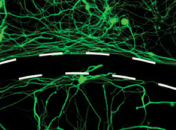 Image: Scientists have created a drug that helps nerve fibers cross scar tissue barriers after spinal cord injury (Photo courtesy of the NIH).