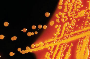 Image: Colonies of Escherichia coli bacteria grown on a Hektoen enteric agar plate medium (Photo courtesy of the CDC – US Centers of Disease Control and Prevention).