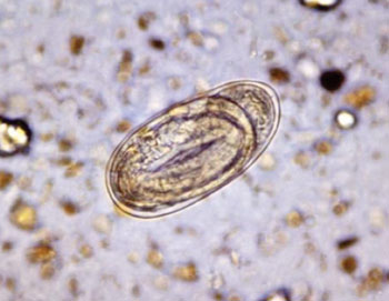 Image: Photomicrograph of an embryonated egg in a stool sample, which is indistinguishable between the Ancylostoma duodenale or Necator americanus hookworm (Photo courtesy of the CDC - US Centers for Disease Control and Prevention).