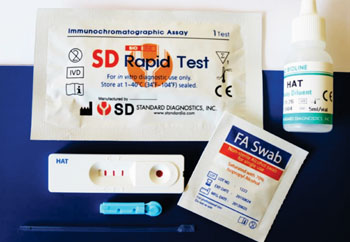 Image: The lateral flow rapid diagnostic test (RDT) for Trypanosoma brucei gambiense, human African trypanosomiasis (HAT) (Photo courtesy of Standard Diagnostics, Inc.).