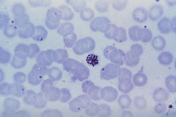 Image: Photomicrograph of Plasmodium falciparum parasites in a blood film stained with Giemsa (Photo courtesy of the Centers for Disease Control and Prevention).