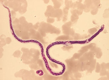 Image: Photomicrograph of the filarial nematode Wuchereria bancrofti in a blood film (Photo courtesy of Dr. Mae Melvin).