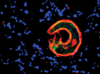 Image: Immunofluorescent staining of hookworm infected mouse lung tissue for worm antigen (green), worm and macrophage bound lectin (red) and cell nuclei (blue) (Photo courtesy of  University of California,  Riverside).