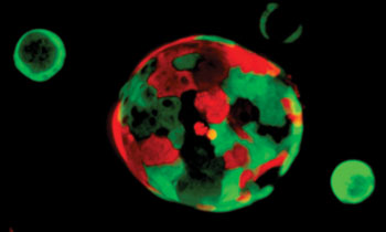 Image: Researchers have developed a three-dimensional culture system to grow organoids from mouse and human pancreatic tissue. The technology promises to change the way pancreatic cancer research is done, offering a path to personalized treatment approaches (Photo courtesy of Cold Springs Harbor Laboratory).