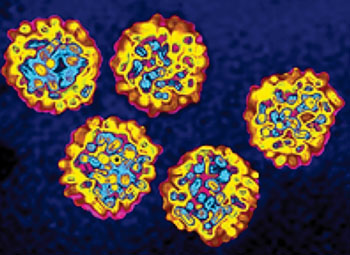 Image: Electron micrograph of particles of the hepatitis C virus (Photo courtesy of James Cavallini).