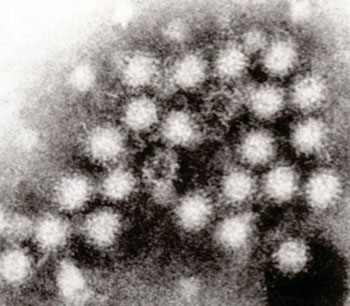 Image: Transmission electron micrograph of norovirus particles in feces (Photo courtesy of Wikimedia Commons).