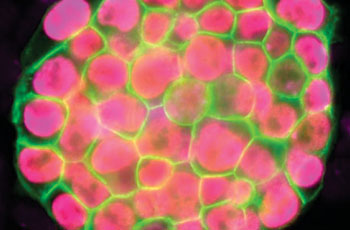 Image: Microscopic view of a colony of induced pluripotent stem cells obtained by reprogramming a specialized cell for two weeks (Photo courtesy of UCLA Broad Stem Cell Research Center/Plath Lab).