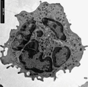 Image: Electron microscope image of a harmful neutrophil (Photo courtesy of the Hebrew University of Jerusalem).