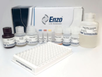 Image: The Histamine ELISA kit (Photo courtesy of Enzo Life Science).