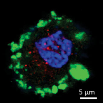 Image: Micrograph showing a rat cell re-programmed to express HNF-6 (red) and insulin (green). The nucleus is stained blue (Photo courtesy of Cornell University).