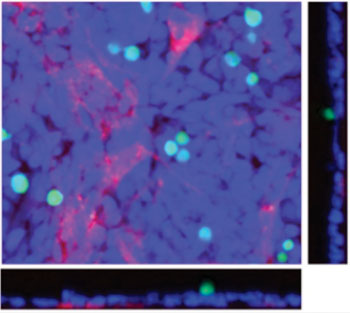 Image: The micrograph shows a multilayered three-dimensional \"organotypic\" platform for quantitative high-throughput screening to identify new therapeutics for ovarian cancer. Fibroblasts are red. Mesothelial cells are blue. Ovarian cancer cells are green. The square image is the XY-planes (up-down, right-left). The images on the sides are Z-planes (depth) (Photo courtesy of Lengyel laboratory, University of Chicago).