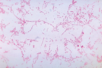 Image: Photomicrograph of Fusobacterium necrophorum (Photo courtesy of the CDC - [US] Centers for Disease Control and Prevention).