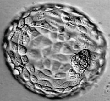 Image: A completely hatched blastocyst of high quality for in vitro fertilization (Photo courtesy of Dr. Richard Sherbahn MD).