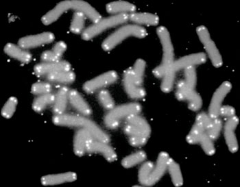 Image: Human chromosomes (grey) capped by telomeres (white) (Photo courtesy of US Department of Energy Human Genome Program).
