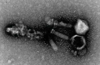 Image: Bacteriophage EFDG1 visualized by transmission electron microscopy (TEM) at a magnification of 20,000–30,000 times. Note that some phages are still bound to remains of the dead bacteria (Photo courtesy of the Hebrew University of Jerusalem).