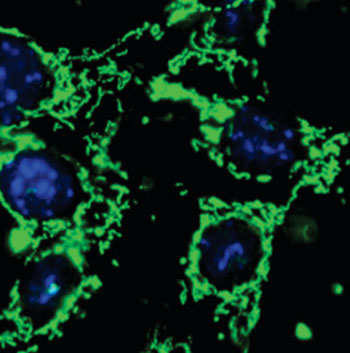 Image: Photomicrograph of mouse embryonic cells that have been programmed to overexpress Higd1a protein (shown in green). This protein slows down the metabolism of cancer cells, allowing them to hibernate and survive long-term (Photo courtesy of the University of California, San Francisco).