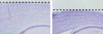 Image: Comparing sections of cortex from a control mouse (left) to a mouse with a presenilin-1 mutation (right). The dashed line indicates the surface of the brain. Presenilin-1 mutations decrease gamma-secretase activity and cause features of neurodegeneration, including shrinkage of the cortex, as shown above (Photo courtesy of Dr. Raymond Kelleher and Dr. Jie Shen, Harvard Medical School).