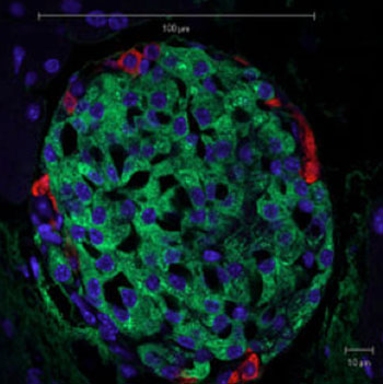 Image: The photo shows a mouse pancreatic islet as seen by light microscopy. Beta cells can be recognized by the green insulin staining. Glucagon is labeled in red and the nuclei in blue (Photo courtesy of Wikimedia Commons).