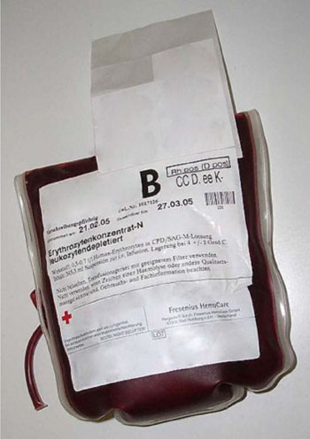 Image: Plastic bag containing 0.5 to 0.7 liters of packed red blood cells in citrate, phosphate, dextrose, and adenine (CPDA) solution (Photo courtesy of Fresenius HemoCare).