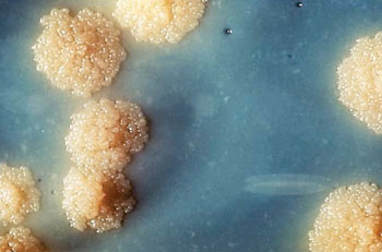 Image: Mycobacterium tuberculosis culture revealing this organism’s typical morphologic characteristics of colorless rough surface, which are seen in M. tuberculosis colonial growth (Photo courtesy of Dr. George Kubica).
