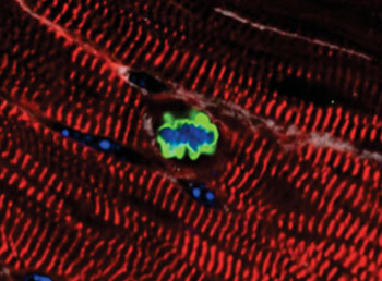 Image: An adult cardiomyocyte has re-entered the cell cycle after expression of miR302-367 (Photo courtesy of the laboratory of Dr. Edward Morrisey, University of Pennsylvania).