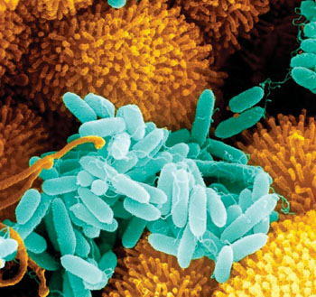 Image:  Scanning electron micrograph of Pseudomonas aeruginosa from cultured biofilms in the respiratory tract of patients with cystic fibrosis (Photo courtesy of Science Photo Library).