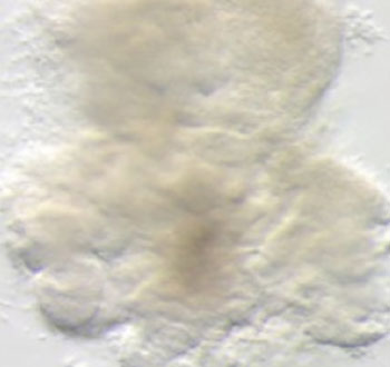 Image: The photomicrograph shows the three-dimensional structure of a laboratory grown human lung organoid. This self-organizing structure mimics the natural complexity of the human lung (Photo courtesy of the University of Michigan).