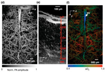 Image: Fast functional photoacoustic microscopy of the mouse brain. Figure (d) shows a representative x-y projected brain vasculature image through an intact skull. Figure (e) shows a representative enhanced x-z projected brain vasculature image. Figure (f) shows photoacoustic microscopy of oxygen saturation of hemoglobin in the mouse brain, acquired by using the single-wavelength pulse-width-based method with two lasers (Photo courtesy of Washington University).
