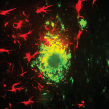 Image: Star-like glial cells in red surround alpha-beta plaques in the cortex of a mouse with a model of Alzheimer\'s disease (Photo courtesy of Strittmatter laboratory/Yale University).