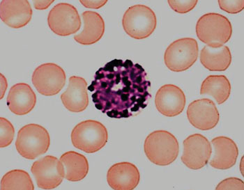 Image: An activated basophil in a blood film (Photo courtesy of The Tulane University).