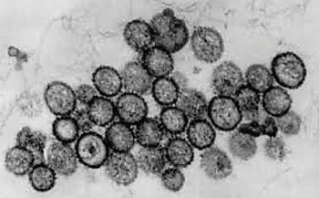 Image: Transmission electron micrograph of Puumala virus (Photo courtesy of Hans R. Gelderblom and Freya Kaulbars).