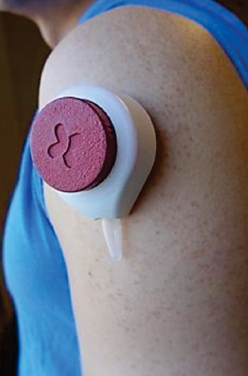 Image: A device the size of a pingpong ball can extract a small blood sample while held against the skin for two minutes (Photo courtesy of David Tenenbaum).