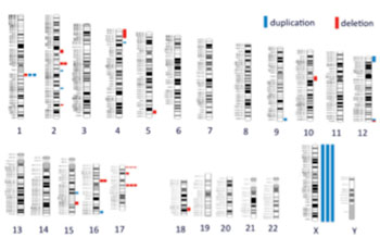 Image: Depiction of genomic imbalances detected in patients with chronic kidney disease. The human chromosomes are shown (numbered). The colored bars represent the pathogenic genomic deletions (red) and duplications (blue) detected in a patient. In total, the study identified 21 different genetic lesions in 31 patients, indicating that most patients had a unique genomic pathology. The size of each bar is proportional to the size of the genomic lesion (Photo courtesy of Dr. Ali Gharavi, Columbia University).