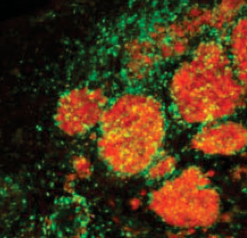 Image: Tagged therapeutic stem cells (green) are targeting breast cancer metastases (red) in the brain of a mouse model (Photo courtesy of Dr. Khalid Shah, Massachusetts General Hospital).
