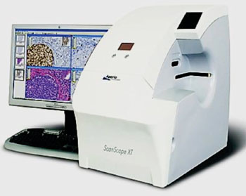 Image: The Aperio ScanScope XT Slide Scanner (Photo courtesy of Aperio Technologies).