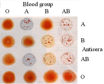 Image: Hemagglutination test of red cells used for typing ABO blood groups (Photo courtesy of University College London).
