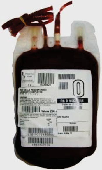 Image: A unit of O Rh Negative red cells for use in blood transfusion (Photo courtesy of New Zealand Blood Services).