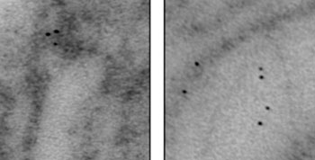 Image: An electron microscope image shows dark-stained O-GlcNAc transferase localized to one complex in the mitochondrial membrane (left) and scattered to the inside of the mitochondria (right) (Photo courtesy of Dr. Partha Banerjee, Johns Hopkins University).