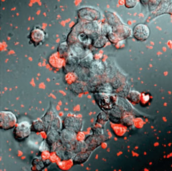 Image: Exosomes loaded with catalase (shown in red) efficiently interact with neurons (shown in black) to protect them from the effects of Parkinson\'s disease (Photo courtesy of Dr. Elena Batrakova, University of North Carolina).
