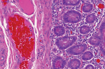 Image: Micrograph of human intestine from a patient with an inflammatory disease (Photo courtesy of the University of Manchester).