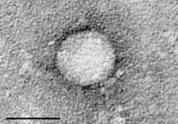 Image: Electron micrograph of Hepatitis C virus purified from cell culture. Scale bar is 50 nanometers (Photo courtesy of the Center for the Study of Hepatitis C, the Rockefeller University).