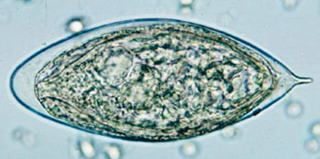 Image: Egg of Schistosoma haematobium in a wet mount of urine concentrates, showing the characteristic terminal spine (Photo courtesy of US Centers for Disease Control and Prevention).