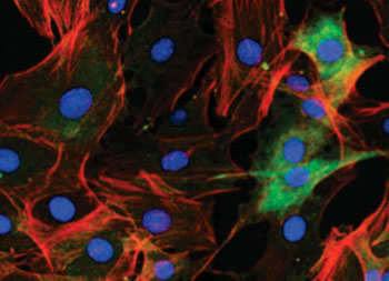 Image: In rheumatoid arthritis, fibroblast-like synoviocytes—specialized cells that line the inside of joints—invade and destroy the affected joint\'s cartilage. Ezrin, which plays in important role in cell adhesion and migration, is shown in green, actin in red, and the cells\' nuclei in blue (Photo courtesy of Dr. Karen Doody and Dr. Bill Kiosses, La Jolla Institute of Allergy and Immunology).