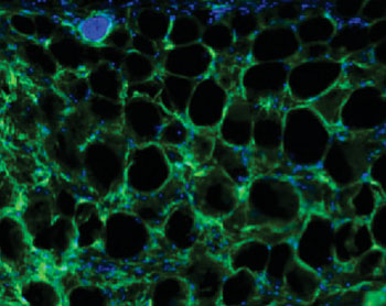 Image: Fluorescent microscopic image of fibrotic scars in fat tissue. In this image, the fat cells are not labeled and appear as black holes surrounded by green collagen (the main component of scar tissue). Cell nuclei are blue (Photo courtesy of Dr. Lorin Olson, Oklahoma Medical Research Foundation).