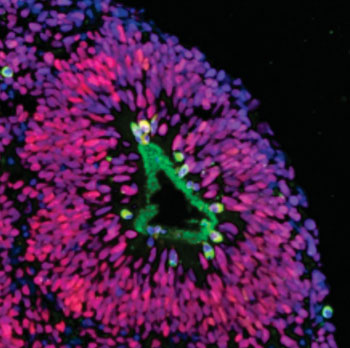 Image: A cross section of a human cortical spheroid shows dividing neural progenitor cells (green) against a background of non-dividing neural cells (red) (Photo courtesy of the Pasca laboratory, Stanford University).