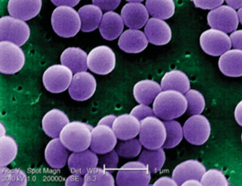 Image: Scanning electron micrograph (20,000x) of a strain of Staphylococcus aureus (Photo courtesy of the CDC - [US] Centers for Disease Control and Prevention).