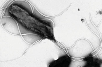 Image: Electron micrograph of an Helicobacter pylori bacterium with its flagella, negative staining (Photo courtesy of Wikimedia Commons and Prof. Yutaka Tsutsumi, MD, Fujita Health University School of Medicine, Japan).