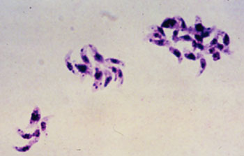 Image: Toxoplasma gondii tachyzoites from ascites fluid (Photo courtesy of Dr. L.L. Moore, Jr.).
