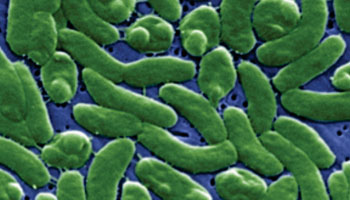 Image: False color scanning electron micrograph of Vibrio vulnificus bacteria (Photo courtesy of the CDC - [US] Centers for Disease Control and Prevention).