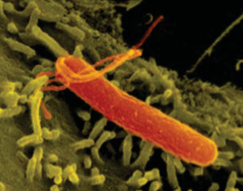Image: The stomach bacterium Helicobacter pylori changes the activity of genes in gastric cells (Photo courtesy of Max Planck Institute for Infection Biology).